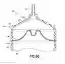 Fig. 67 - Bladder syringe fluid delivery system