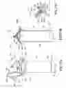 Fig. 70 - Bladder syringe fluid delivery system