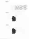 Fig. 03 - Inhalation device and method for inhaling powders