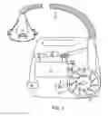 Fig. 02 - Method and apparatus for improving flow and pressure estimation in CPAP systems