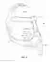 Fig. 04 - Sealing force detection enabled, therapeutic fluid delivery device