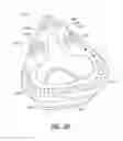 Fig. 07 - Sealing force detection enabled, therapeutic fluid delivery device