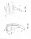 Fig. 17 - Sealing force detection enabled, therapeutic fluid delivery device