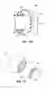 Fig. 34 - Patient interface systems