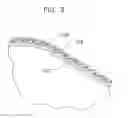 Fig. 04 - High pressure balloon
