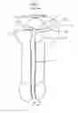 Fig. 02 - Stretch valve balloon catheter and methods for producing and using same