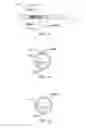 Fig. 08 - Stretch valve balloon catheter and methods for producing and using same