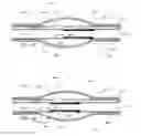 Fig. 16 - Stretch valve balloon catheter and methods for producing and using same