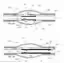 Fig. 20 - Stretch valve balloon catheter and methods for producing and using same