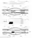 Fig. 21 - Stretch valve balloon catheter and methods for producing and using same