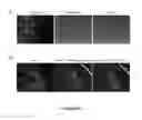 Fig. 08 - Microneedle based cell delivery