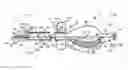 Fig. 01 - Catheter and catheter system for electrical neuromodulation