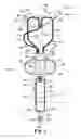 Fig. 05 - Catheter and catheter system for electrical neuromodulation