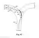 Fig. 10 - Catheter and catheter system for electrical neuromodulation