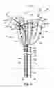 Fig. 14 - Catheter and catheter system for electrical neuromodulation