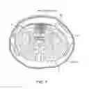 Fig. 09 - ELECTRODE ARRAY CONFIGURED TO WRAP AROUND AND STIMULATE THE SPINAL CORD