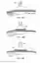 Fig. 32 - ELECTRODE ARRAY CONFIGURED TO WRAP AROUND AND STIMULATE THE SPINAL CORD