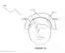 Fig. 16 - Electrode system for electrical stimulation
