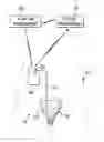 Fig. 01 - Methods, systems and devices for determining optimal placement for pudendal nerve stimulation lead using patient feedback