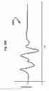 Fig. 46 - Throw-and-catch based toy with free fall sensing, impact sensing, and speaker output