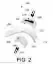 Fig. 03 - Methods for stator bar shape tooling