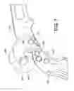 Fig. 07 - Compound wire rope cutter