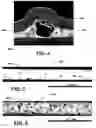 Fig. 06 - ABRASIVE ARTICLE AND METHOD OF FORMING
