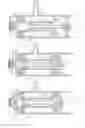 Fig. 03 - Board fastening tool