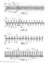 Fig. 04 - Polymeric netting of ribbons and strands and methods of making the same