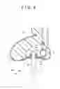 Fig. 07 - Fixing structure for surface skin, and vehicle seat