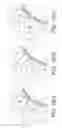 Fig. 12 - Drive system for landing gear and drive system control method