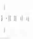 Fig. 02 - Monoclonal antibodies against HER2 epitope and methods of use thereof