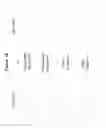 Fig. 03 - Monoclonal antibodies against HER2 epitope and methods of use thereof