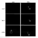 Fig. 01 - Selective immunodepletion of endogenous stem cell niche for engraftment