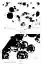 Fig. 16 - Dissolution of oxidized cellulose