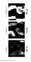 Fig. 17 - Fluoro-alcohol additives for orientation control of block copolymers
