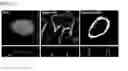 Fig. 16 - HYALURONIC ACID DERIVATIVES AND COMPOSITION FOR CELL-SURFACE ENGINEERING USING THE SAME