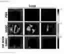 Fig. 33 - HYALURONIC ACID DERIVATIVES AND COMPOSITION FOR CELL-SURFACE ENGINEERING USING THE SAME