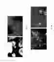 Fig. 02 - MACS-based purification of stem cell-derived retinal pigment epithelium