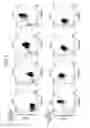Fig. 04 - CD82-positive cardiac progenitor cells
