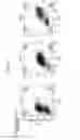 Fig. 05 - CD82-positive cardiac progenitor cells