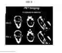 Fig. 07 - RADIOLABELING OF ADENO ASSOCIATED VIRUS