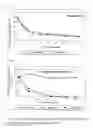 Fig. 03 - MICROSOMES IRREVERSIBLY INHIBITED FOR CYP450 THEIR USES IN THE PHENOTYPING OF ENZYMATIC METABOLIC PATHWAYS