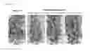 Fig. 09 - Plants having increased tolerance to herbicides