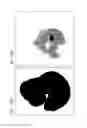 Fig. 20 - Methods and compositions for the targeted modification of a mouse embryonic stem cell genome