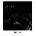 Fig. 13 - Nanoscale imaging of proteins and nucleic acids via expansion microscopy