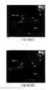 Fig. 15 - Nanoscale imaging of proteins and nucleic acids via expansion microscopy