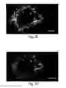 Fig. 22 - Nanoscale imaging of proteins and nucleic acids via expansion microscopy