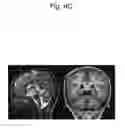 Fig. 14 - DETECTION METHOD FOR GENETIC DISEASE