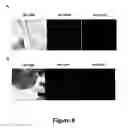 Fig. 09 - Test for the cytological analysis of cervical cells